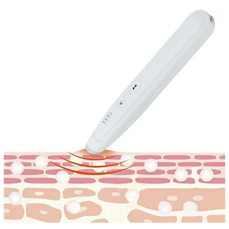 Masažni uređaj Sorbo Itch Healer